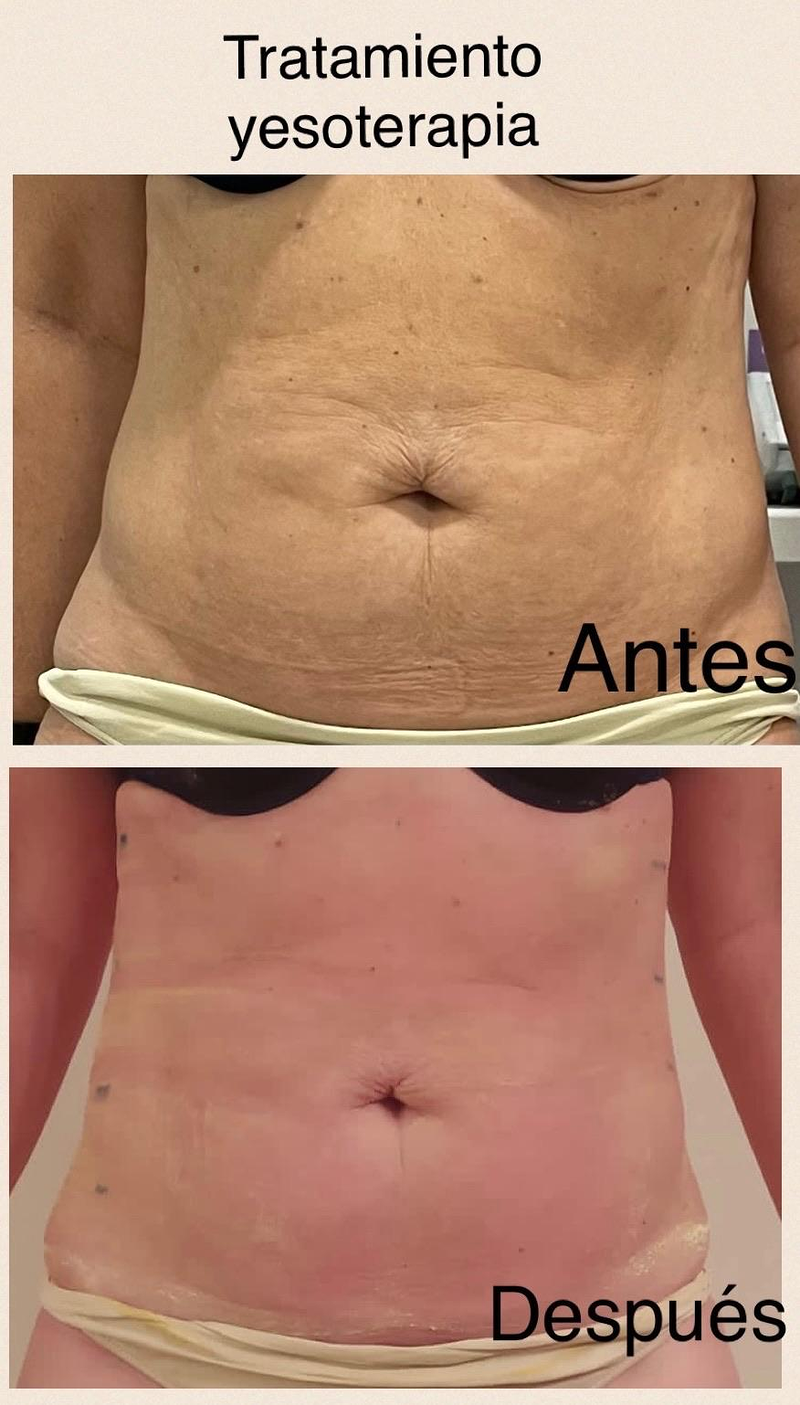 Images Centro De Estética Avanzada Y Láser Verónica Vico