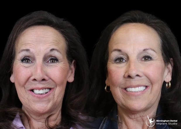 Images Birmingham Dental Implant Studio