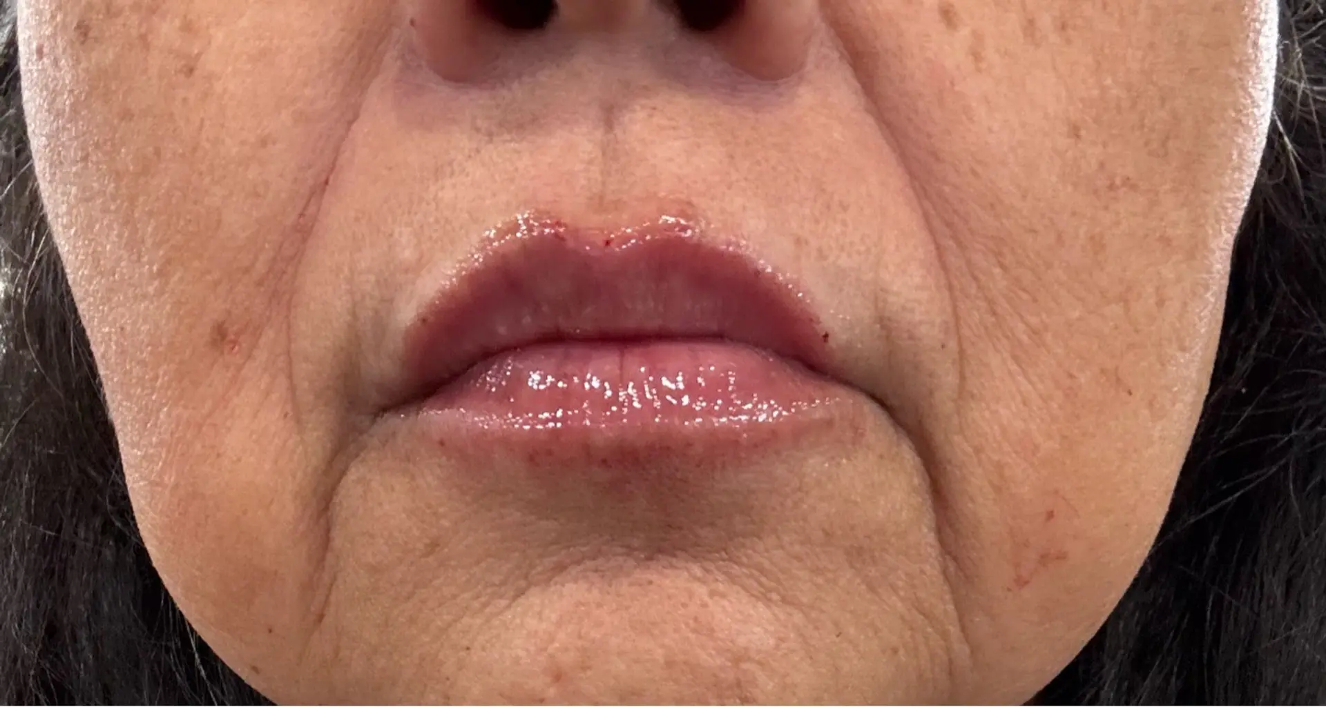 Close-up shot of a woman's mouth and lower face, with her lips appearing glossy and slightly plumped. There are visible wrinkles around her mouth and on her chin. Her skin tone is warm, and she has dark hair visible on the sides.
