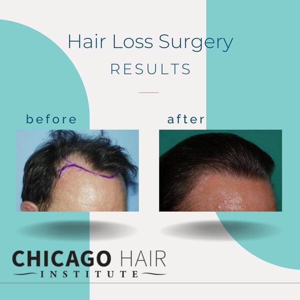 Images Chicago Hair Institute