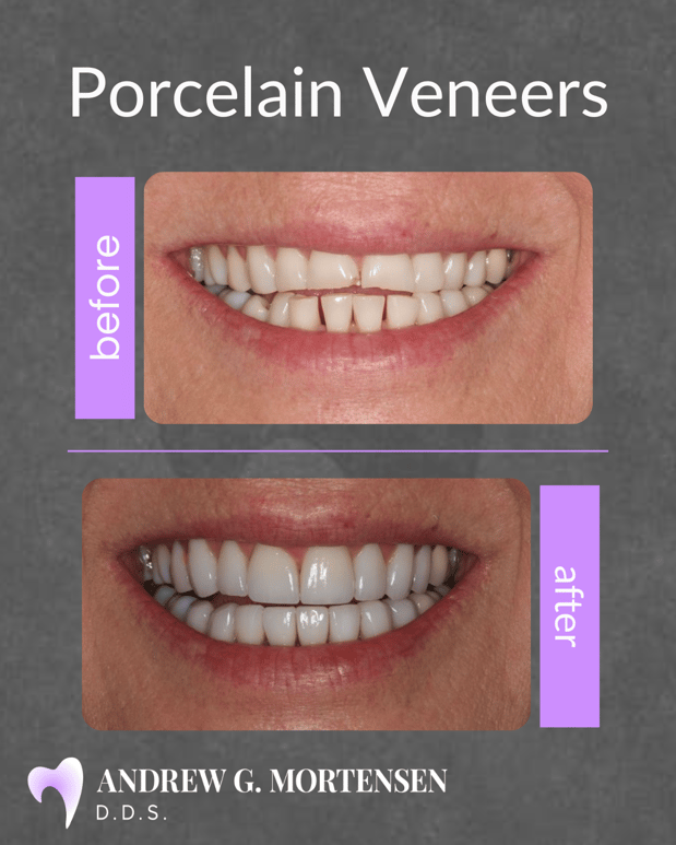 Images Andrew G. Mortensen, DDS