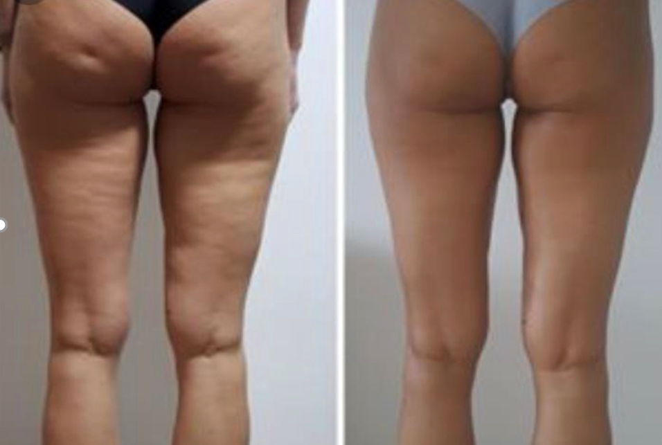 Vacuum Fit 100, Ackerstrasse 16 in Kloten