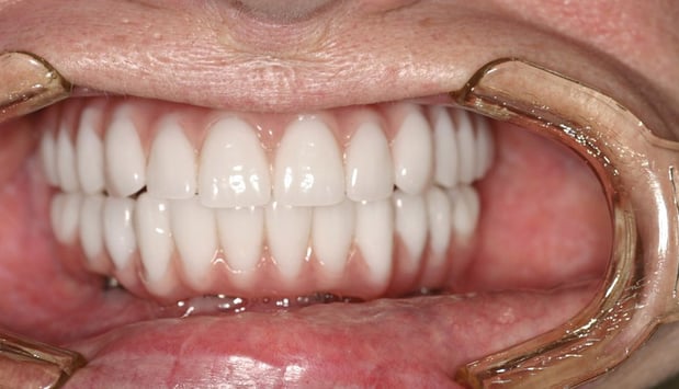 Images Harborside Dental Team