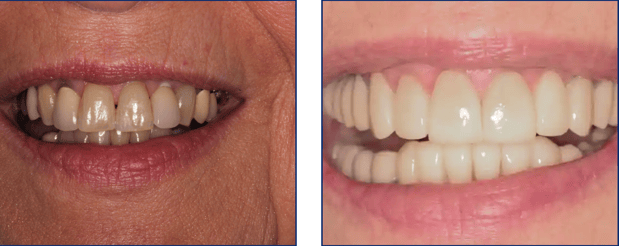 Images Preference Dental (Mecosta)