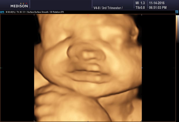 Images Heavenly 3D 4D Ultrasounds