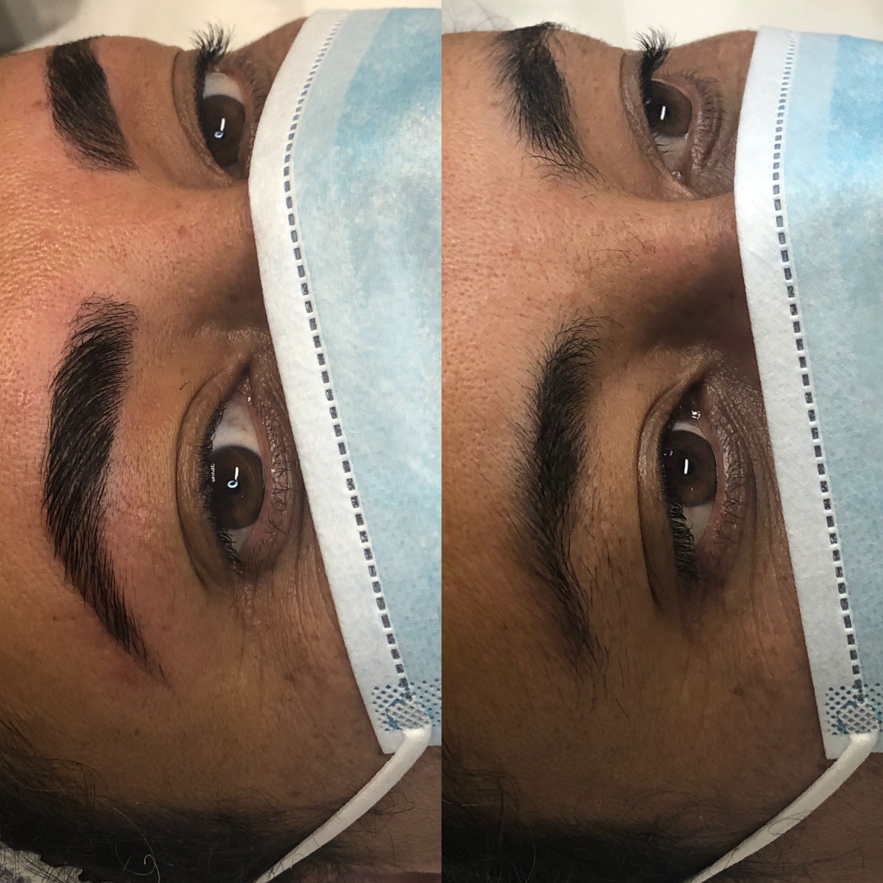 Images Clinique d'Esthétique Leila - Hydrafacial, Microblading, Épilation Laser Sainte-Foy