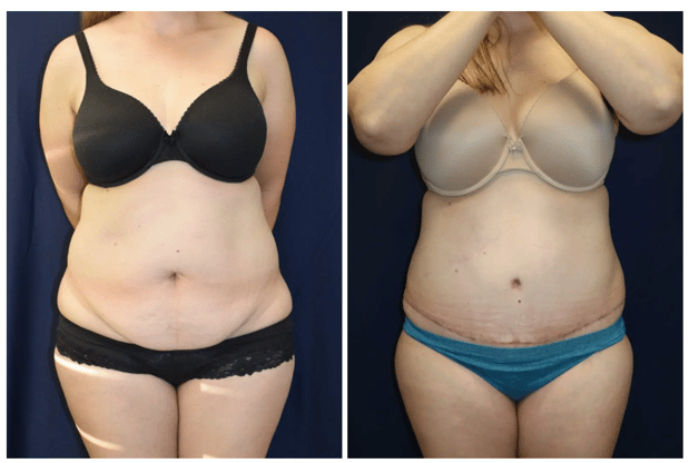 Images Columbia Aesthetic Plastic Surgery