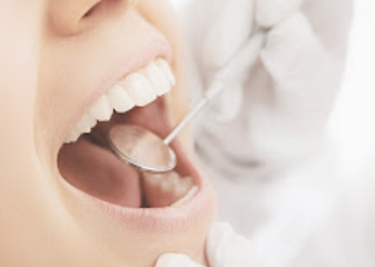 Images Swissdentalmed - Conex Dental Italia