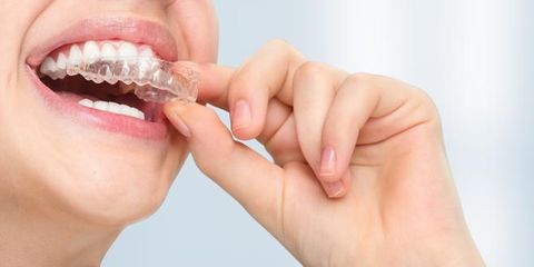 3 Ways to Know if Invisalign Is Right for You Mark Stephens DMD Richmond (859)626-0069