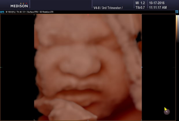 Images Heavenly 3D 4D Ultrasounds
