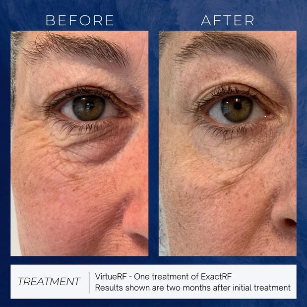Images Cosmetic Enhancement Center of New England Waterville