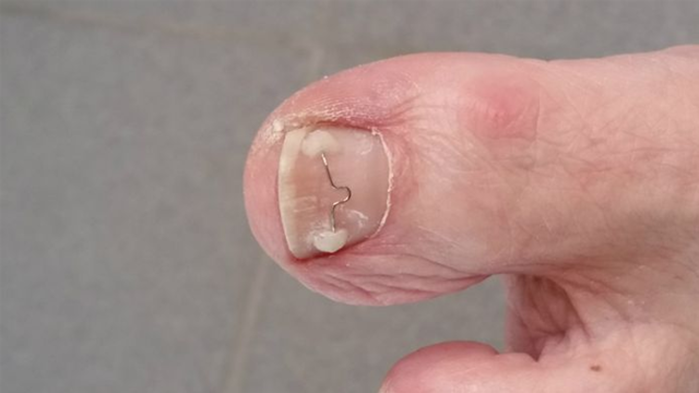 Images Kongsberg Fotterapi AS