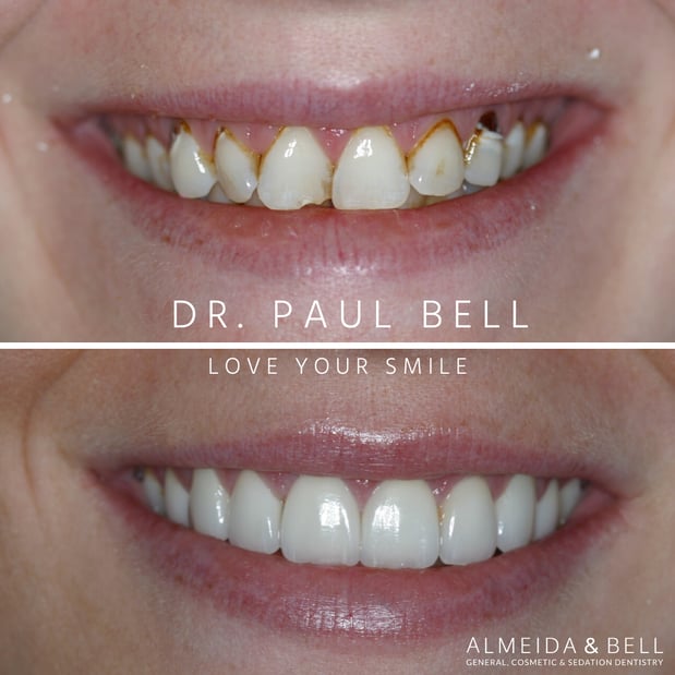 Images Almeida & Bell Dental Lone Tree - General, Cosmetic, and Implant Dentistry