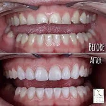 Images Irvine Smile Dentistry