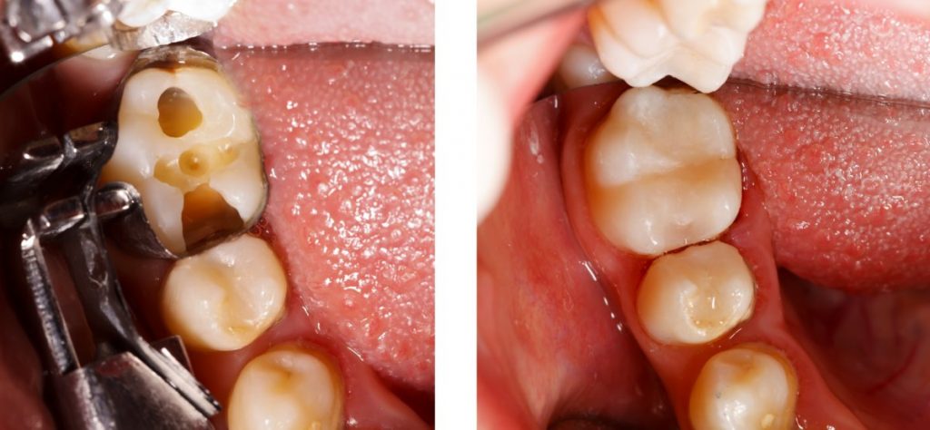 Images Clinique Dentaire Dr. Karam - Dentiste, Blanchiment Dentaire Ahuntsic