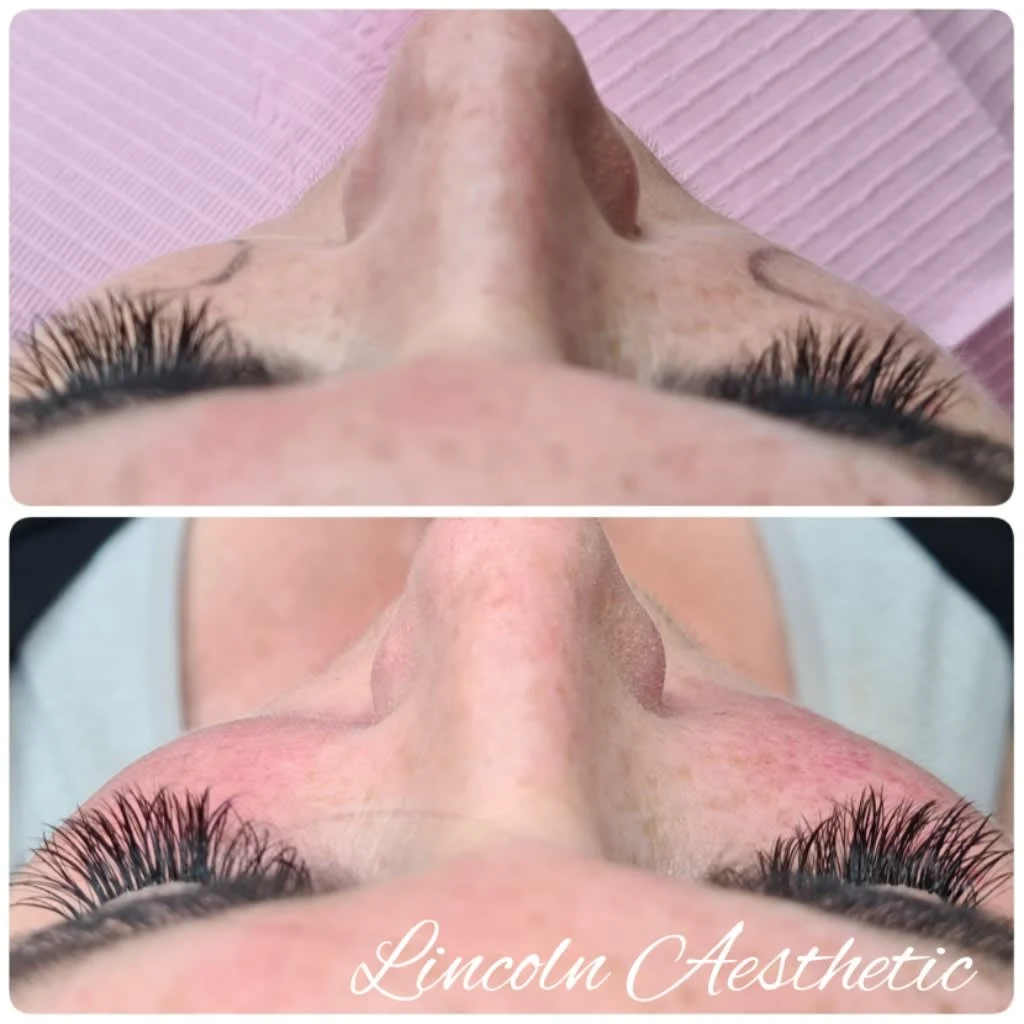 Images Lincoln Aesthetic