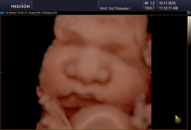 Images Heavenly 3D 4D Ultrasounds