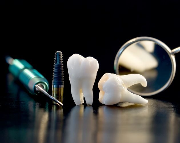 Images Smile Maker Implant & General Dentistry