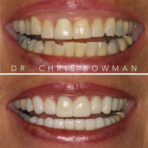 Images Advanced Dentistry of Charlotte