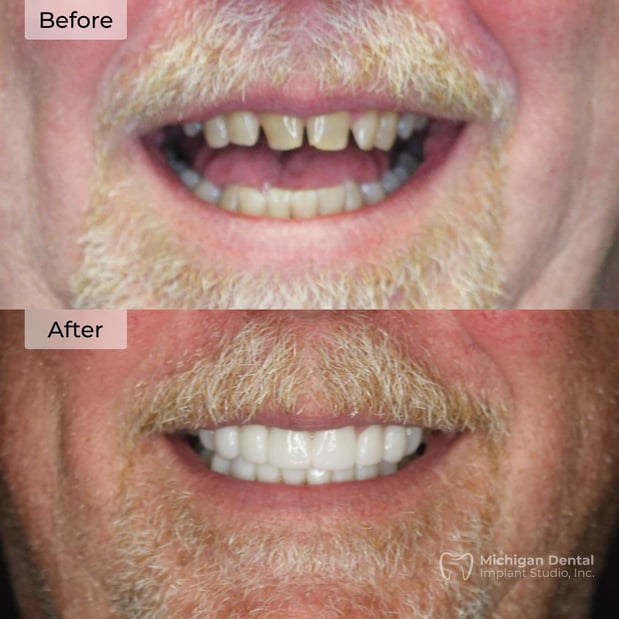 Images Michigan Dental Implant Studio