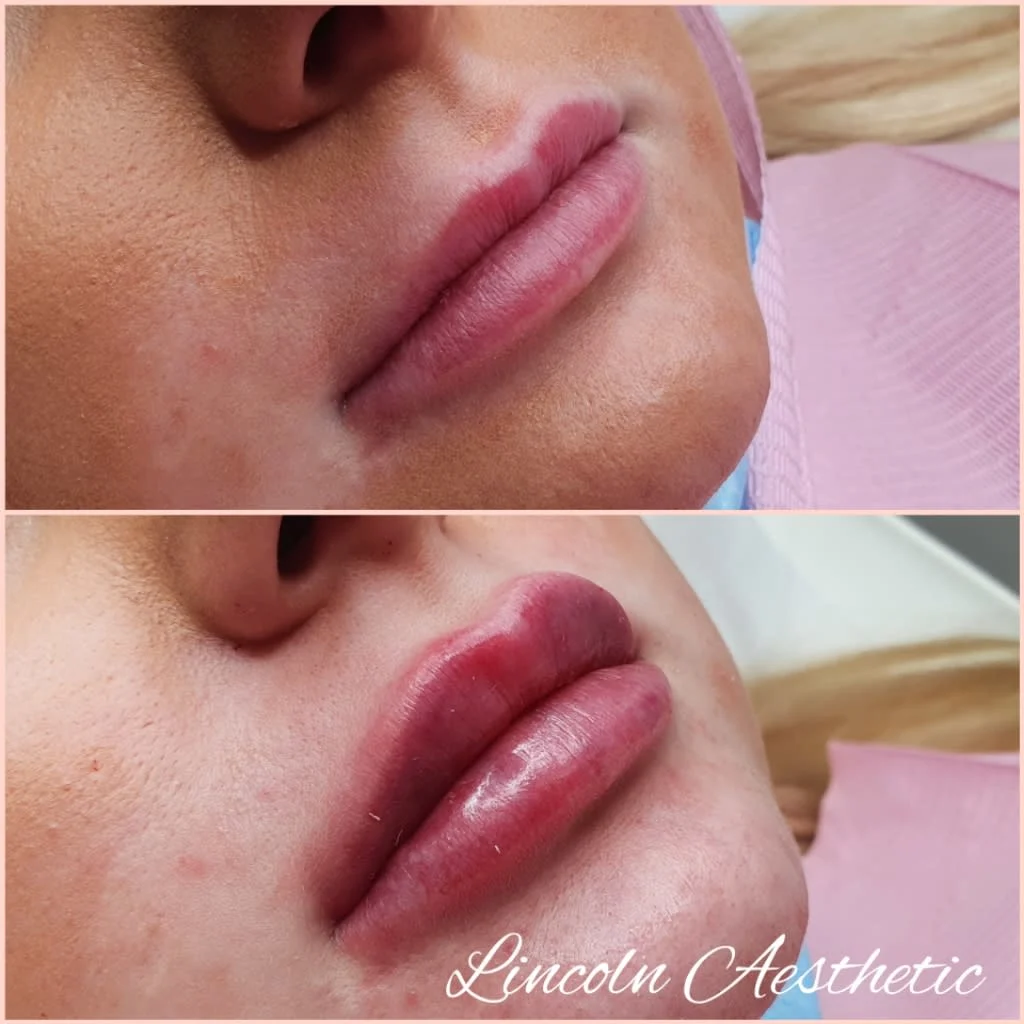 Images Lincoln Aesthetic