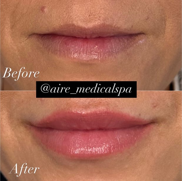 Images Aire Medical Spa