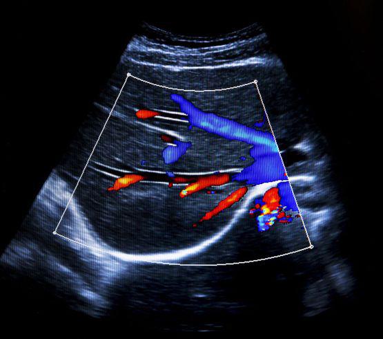 Bilder Echographie à domicile et en EMS, IRM ouverte, Scanner, Mammographie Dr Lacrosniere