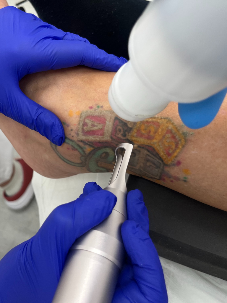 Images Dra. Silvia Solà. Medicina Estética y Láser