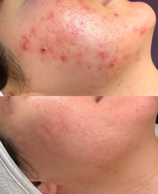 Images Le Vardia Skin