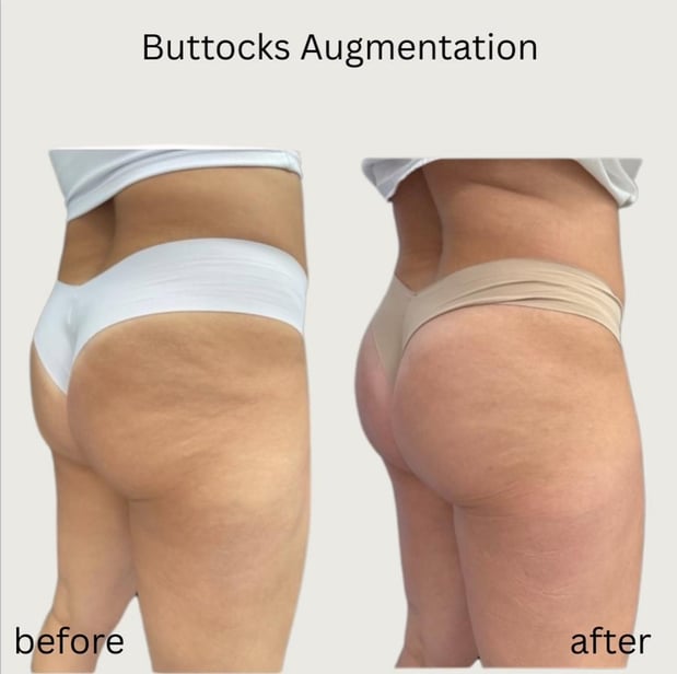 Images DermaSpalogy | Best Facials Miami | Botox Medspa Miami