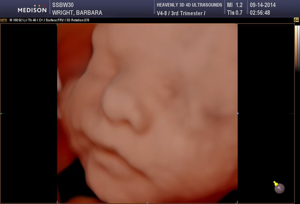 Images Heavenly 3D 4D Ultrasounds-Upland