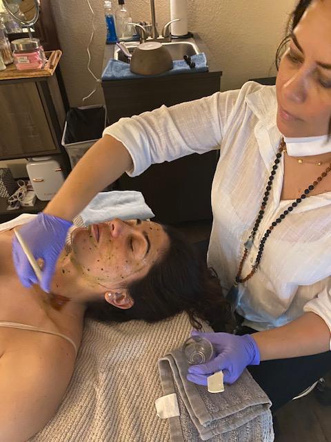 Avani Skin Care - Purifying Acne Treatment