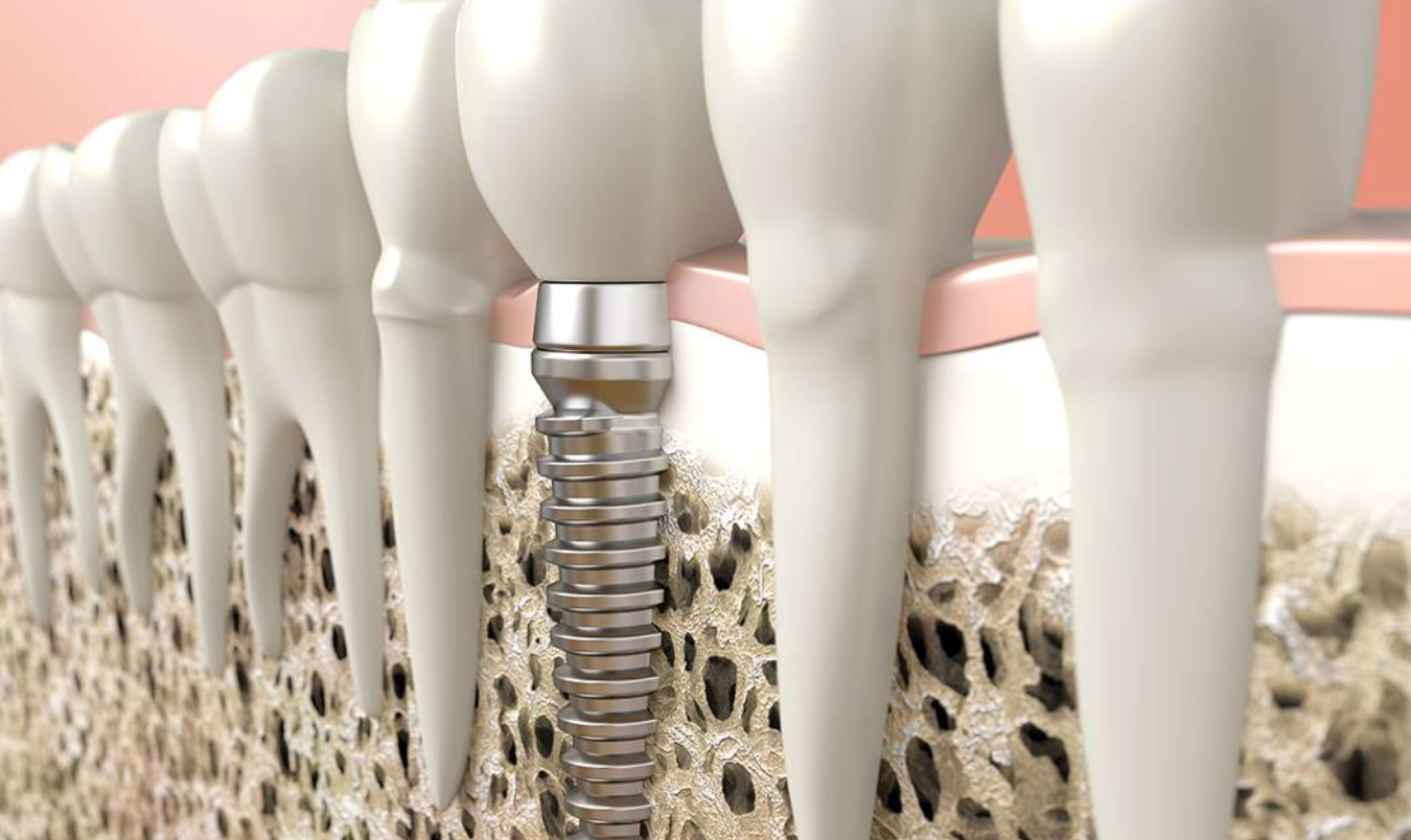 Images Centre de Spécialistes Dentaires Zeeba - Parodontie, Endodontie, Implant dentaire Longueuil