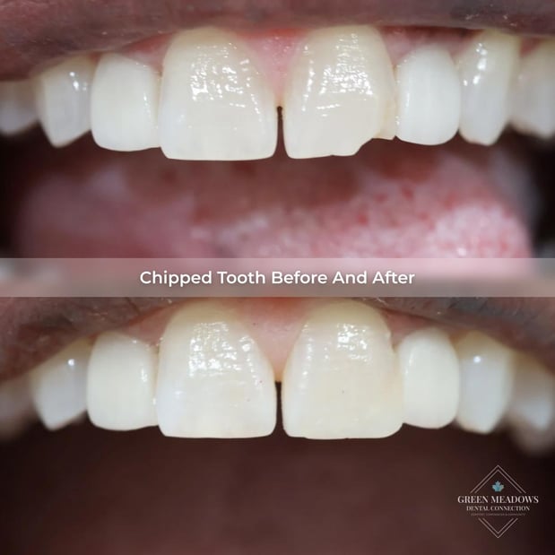 Images Green Meadows Dental Connection