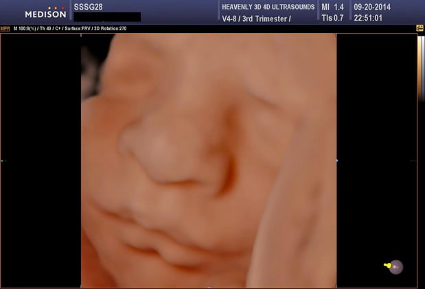 Images Heavenly 3D 4D Ultrasounds-Upland
