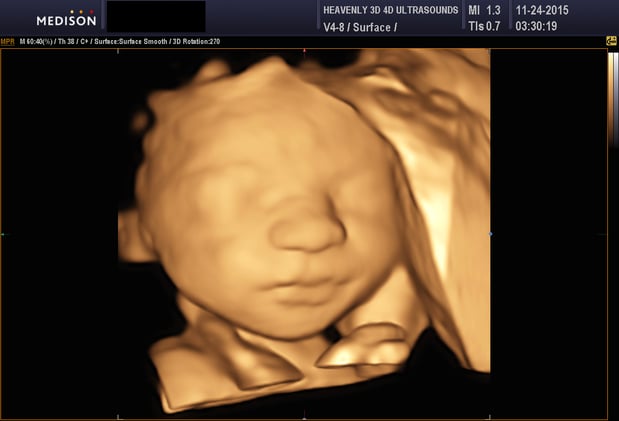 Images Heavenly 3D 4D Ultrasounds-Upland