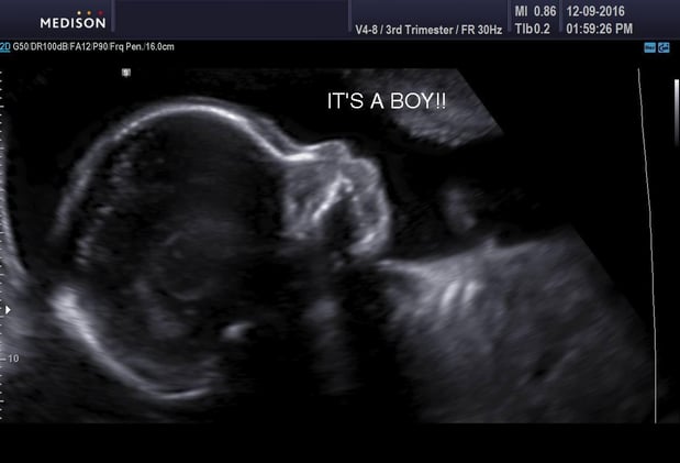 Images Heavenly 3D 4D Ultrasounds