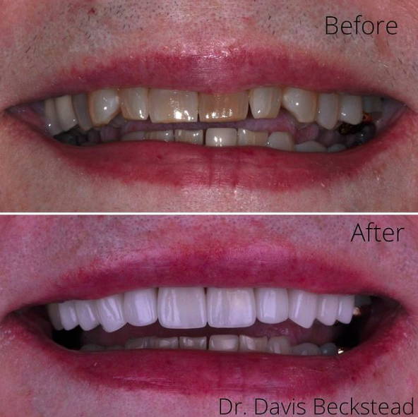 Images Beckstead Dental Group