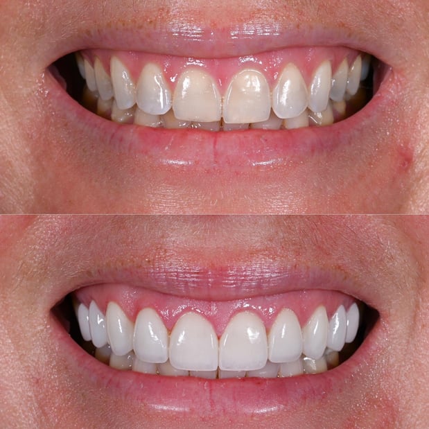 Images Nashville Wisdom Teeth and Implant Solutions