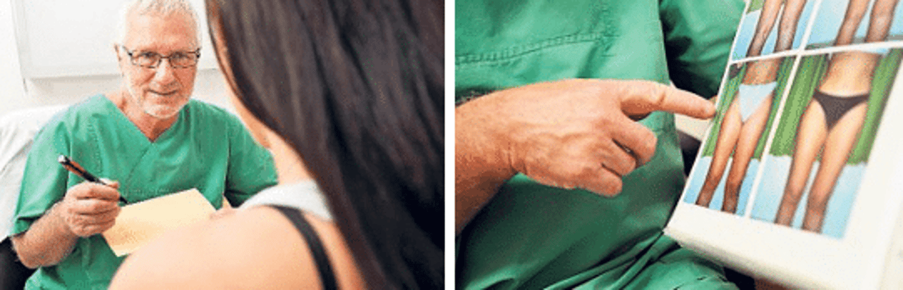 Bilder Medical Aesthetic Fettabsaugen Dr. Urs Benz