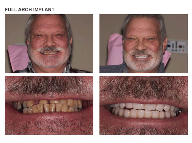 Images Roy Dental Care