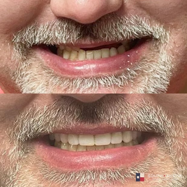 Images South Austin Dental Associates