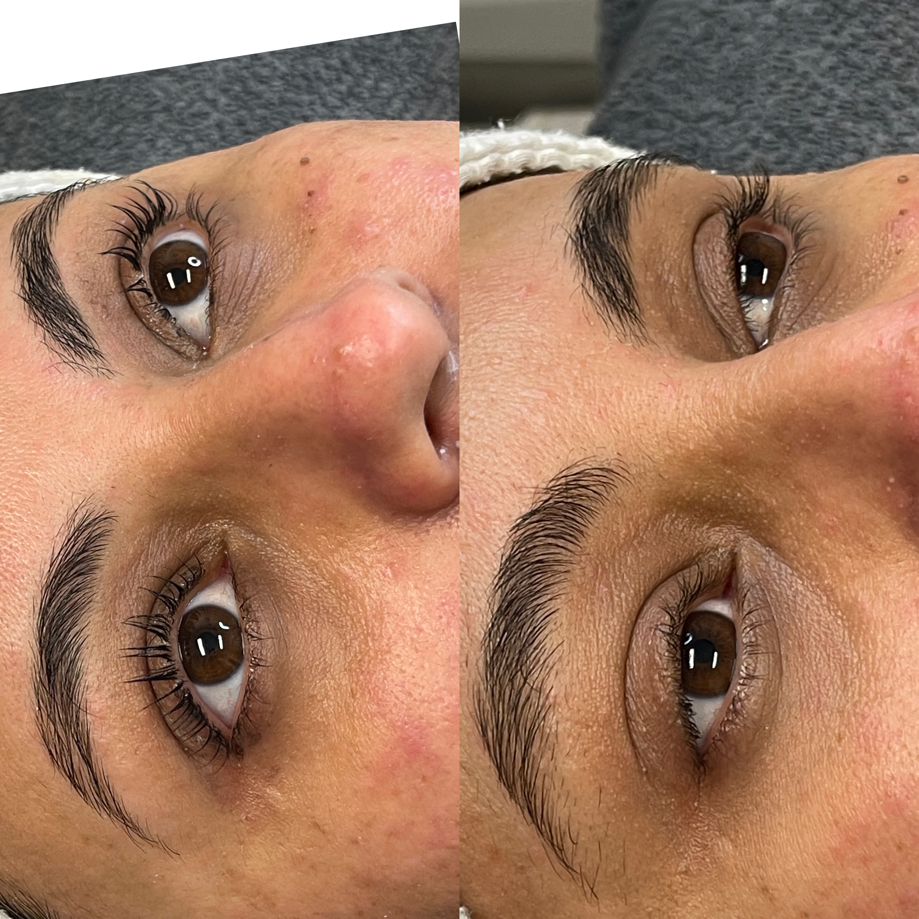 Images Clinique d'Esthétique Leila - Hydrafacial, Microblading, Épilation Laser Sainte-Foy