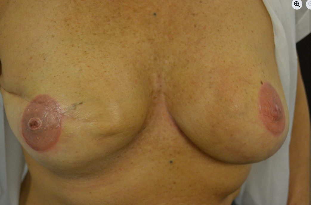 Images Raquel Velasco Micropigmentación