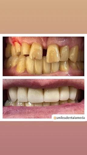 Images Clínica SmilesDent Alameda