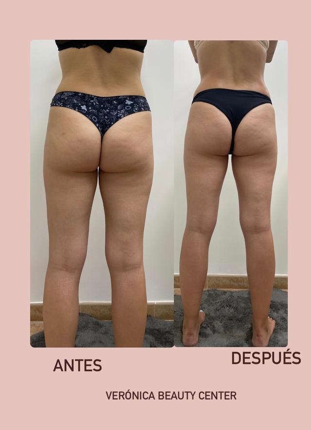 Images Verónica Beauty Center