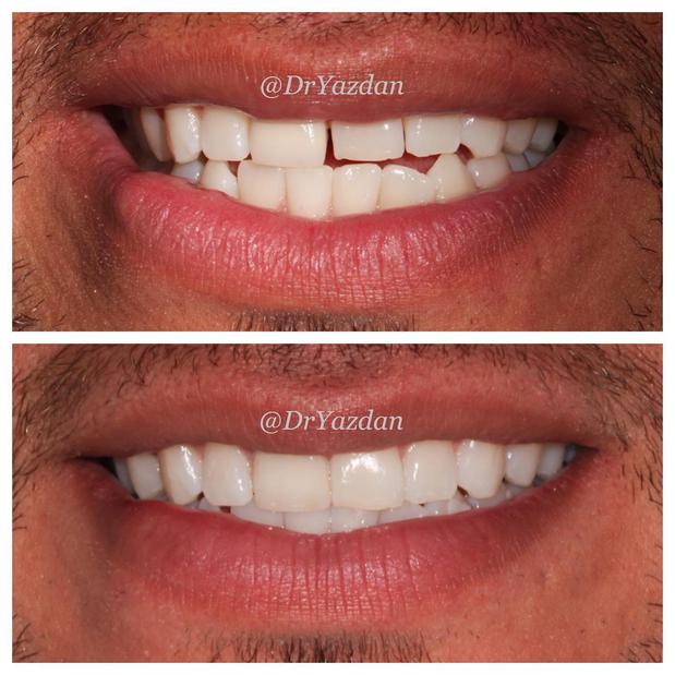 Images Dr. Desiree Yazdan - Center For Restorative & Cosmetic Dentistry