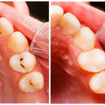 Images Irvine Smile Dentistry