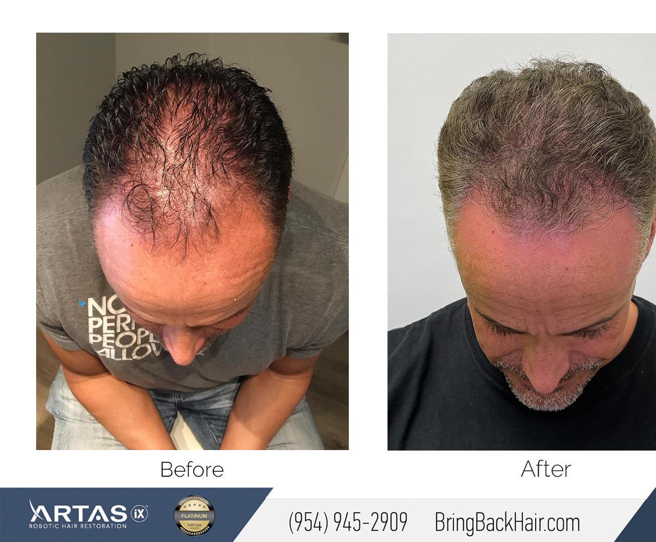 Hair By Dr. Max, Restoration Center, 551 N Federal Hwy, #800, Fort  Lauderdale, FL, Medical Spas - MapQuest