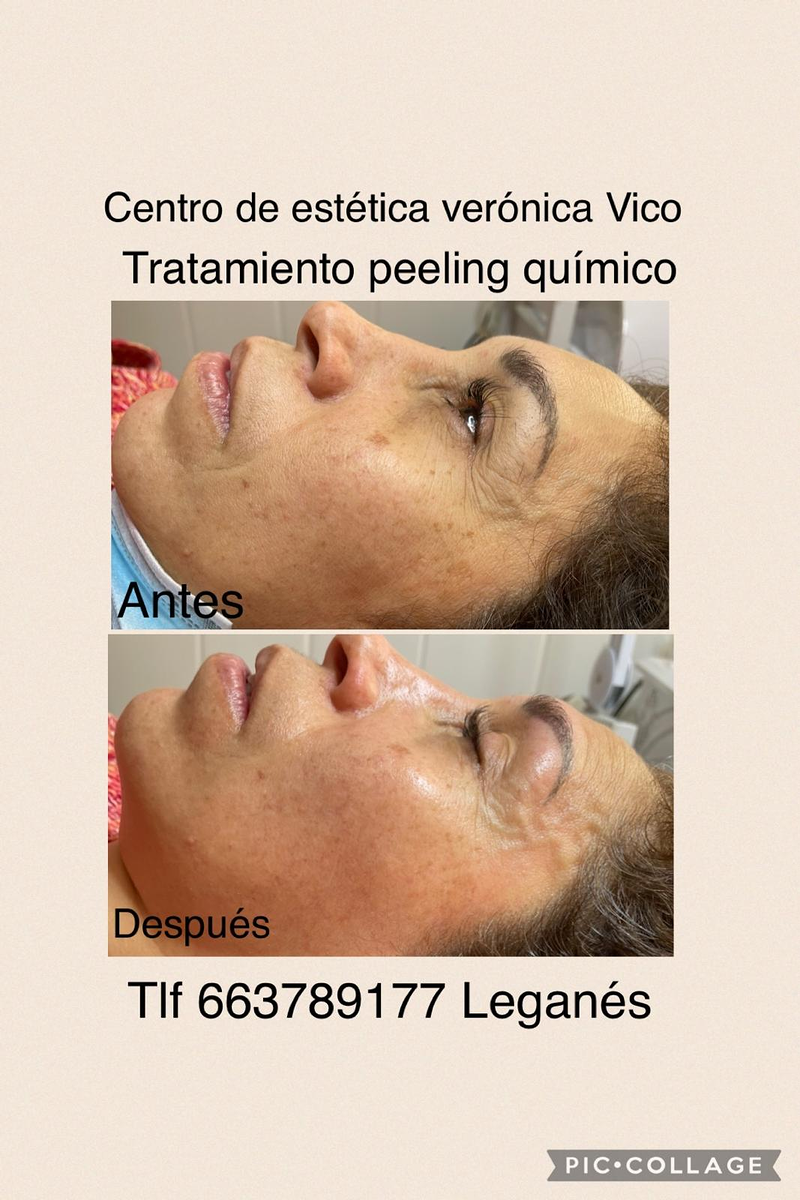 Images Centro De Estética Avanzada Y Láser Verónica Vico